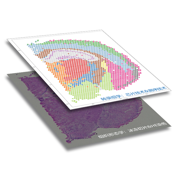 Spatial Transcriptome Services